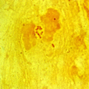 Burkholderia