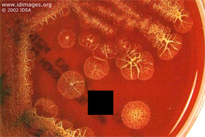 Figure 2.  Culture of <i>Burkholderia pseudomallei</i>.