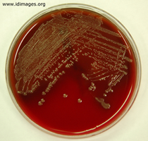 Figure 2.  Growth of <i>Campylobacter jejuni</i>  at 42°F, low oxygen.