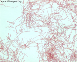 Figure 1.  Gram stain of <i>Fusobacterium nucleatum</i>.