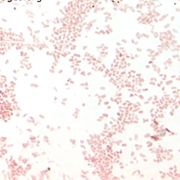 Haemophilus