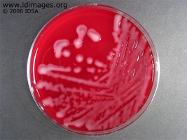 Figure 2.  Growth of Klebsiella on sheep blood agar.