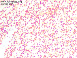 Neisseria Gonorrhoeae Gram Stain