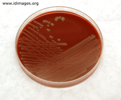 Figure 2.  Culture growing <i>Pasteurella  multocida</i>.