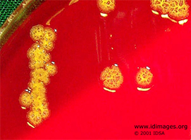 Figure 2.  <em>Pseudomonas oryzihabitans</em> (formerly  called <em>Flavobacterium oryzihabitans</em>).