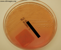 macconkey agar salmonella