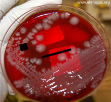 Figure 5.  <i>Salmonella enterica</i> serotype Heidelberg,  on blood agar. 