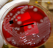 macconkey agar salmonella