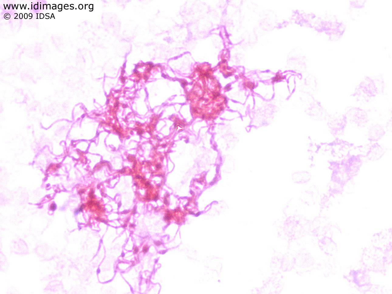 Bacillus megaterium гинцианвиолет. стрептобациллез у детей. стрептобациллы это. органы движения характерные для палочковидных бактерий. стрептобациллы.