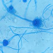 Aspergillus