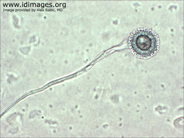 Figure 4.  Aspergillus.  