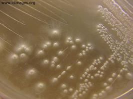 Figure 2.  Colonies of <i>Candida dubliniensis</i>.