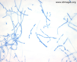 Figure 4.  <i>Coccidioides</i> species seen on tape  prep fromculture growth, lactophenol cotton blue stain.