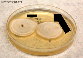 Figure 5.  <i>Coccidioides species</i> on Sabouraud dextrose<br/> agar, cultured from bronchial washings.