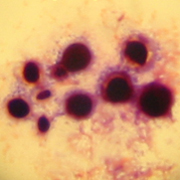 Cryptococcus