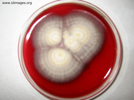 Figure 2.  Culture growth of Fusarium.