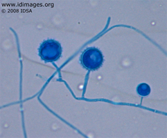 Figure 2.  Blood isolate showing filamentous mold stage of <i>Histoplasma capsulatum</i>.