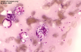 Figure 3.  <i>Penicillium marneffei</i>, Wright stain of skin lesion specimen.