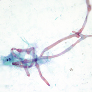 Rhizopus