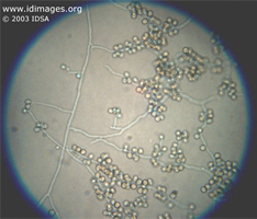 Figure 1.  <i>Sporothrix schenckii</i>.