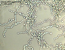 Figure 1.  Trichosporon, growth on cornmeal agar.