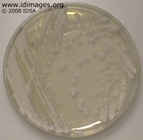 Figure 2.  Trichosporon,growing on Sabouraud  dextrose agar.