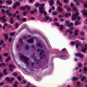 Schistosoma