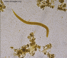 Figure 1.  <i>Strongyloides stercoralis</i>  seen on  examination of stool.