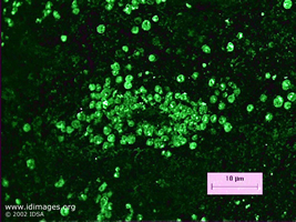 Figure 2.  <i>Acanthamoeba castellanii</i> shown by immunofluorescent staining.