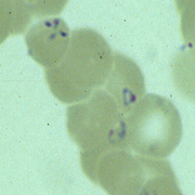 Babesia