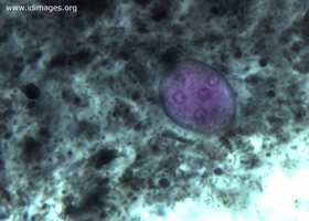 Figure 1.  <i>Entamoeba coli</i> cysts in fecal sample.