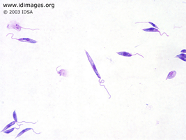 Figure 1.  Culture growth of <i>Leishmania donovani</i>  from bone marrow aspirate.