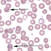 Plasmodium