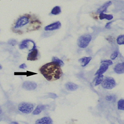 Toxoplasma