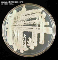 Figure 2.  <i>Prototheca wickerhamii</i> growth from  elbow aspirate.