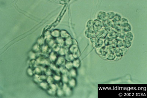 Figure 1. <i>Pythium insidiosum</i>.