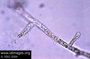 Figure 2. <i>Pythium insidiosum</i>.