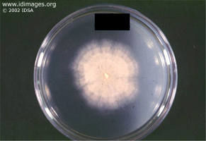 Figure 3. <i>Pythium insidiosum</i> in culture.