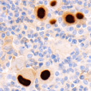 Cytomegalovirus