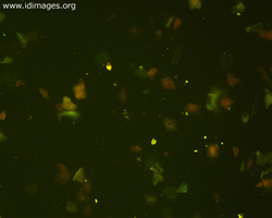 Figure 2.  RSV slide seen in Figure 1, using  FITC filter.