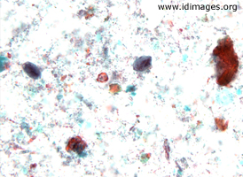 giardia trichrome stain)