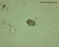 Figure 2.  Hookworm egg (40x magnification).