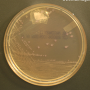 Shigella