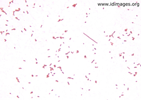 Figure 1.  <i>Yersinia enterocolitica</i> on gram stain.