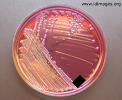 Figure 2.  <i>Yersinia enterocolitica</i> colonies on Cefsulodin-Irgasan-Novobiocin (CIN) agar.