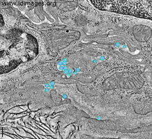 Figure 1.  Virions of HIV seen by tomographic electron microscopy in HIV-1 infected BLT mouse colon, with the virion components modeled and highlighted in color.