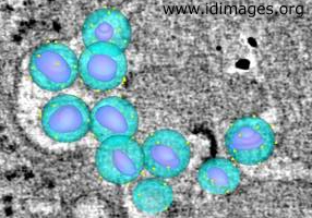 Figure 2.  Detail of Figure 1, showing modeled HIV-1 virons colorized to show envelope (blue), bullet-shaped core (magenta) and presumed surface spikes (yellow).   