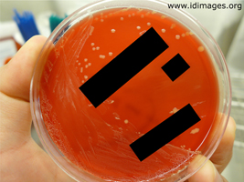 Figure 2.  <i>R. equi</i> colonies on Brucella horse blood plate.