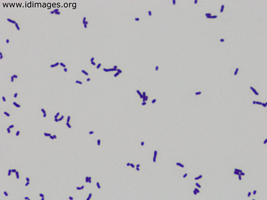 Figure 3.  <i>R. equi</i> shown on gram stain after 24 hours culture growth.