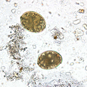 Diphyllobothrium